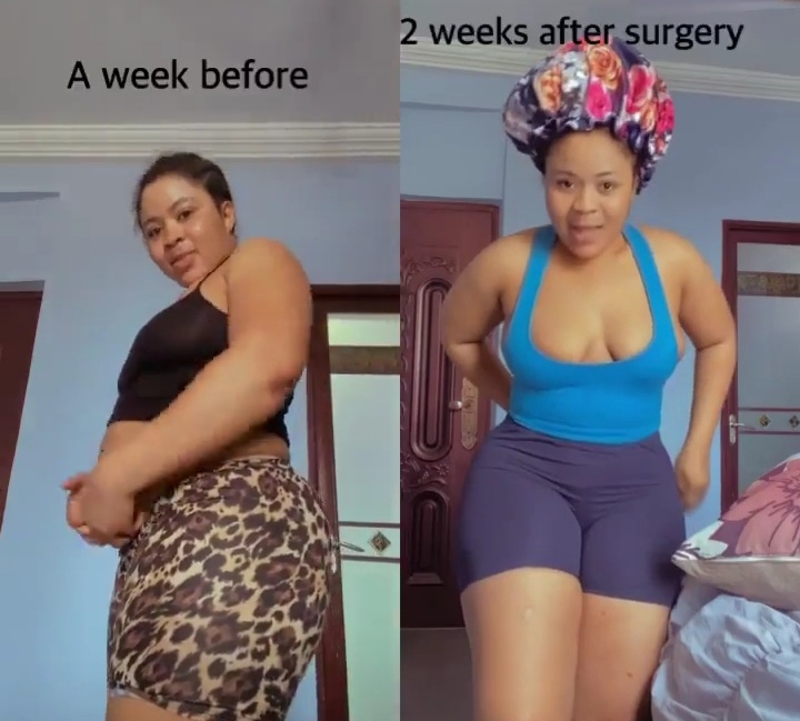  Kisa Gbekle Flaunts Her Before And After Surgery Body In New Video